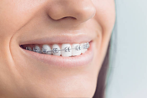 Best Traditional Braces  in Old Orchard, PA